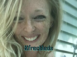 Xfreckledx